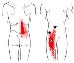 inguinal strain