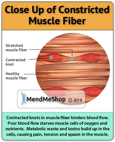 Can Amoxicillin Cause Muscle Spasm 21