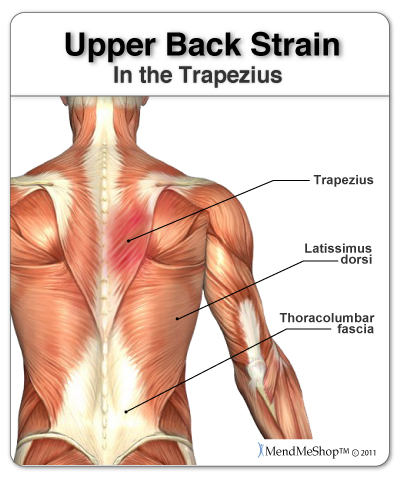 What causes upper back spasms?